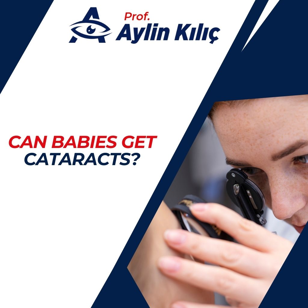 Can Babies Get Cataracts