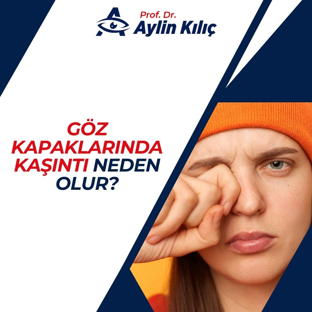 Göz Kapaklarında Kaşıntı Neden Olur (3)