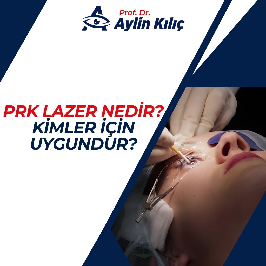 PRK Lazer Nedir Kimler için Uygundur