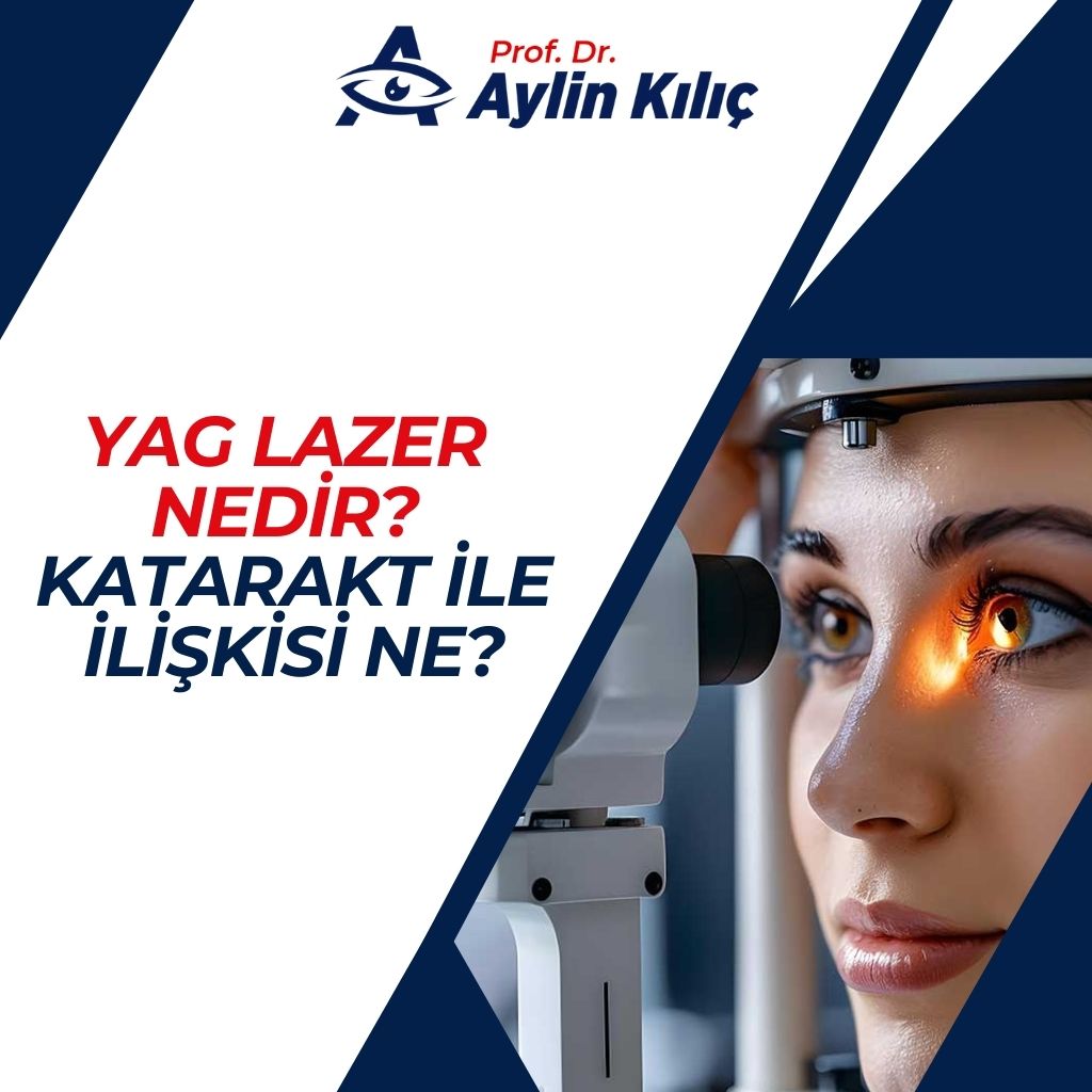 YAG Lazer nedir Katarakt ile İlişkisi Ne