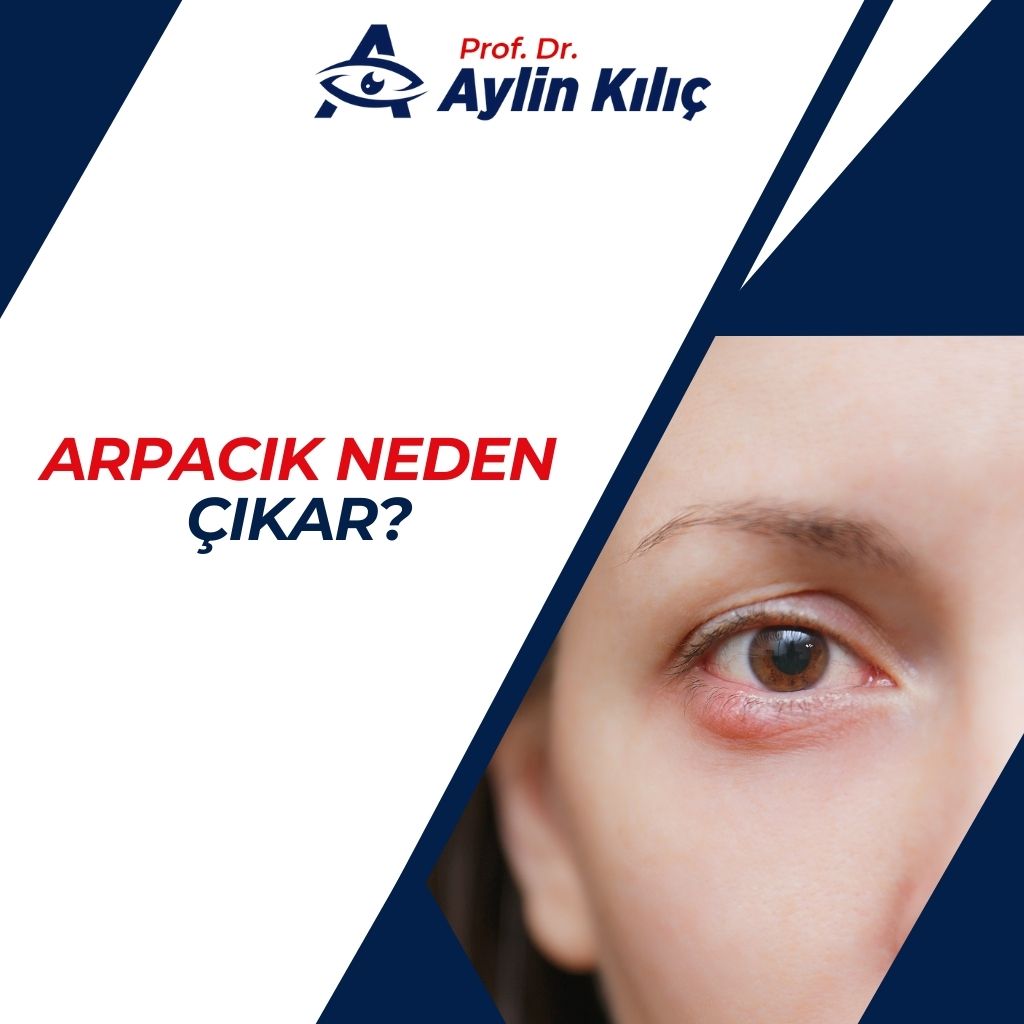 Arpacık Neden Çıkar