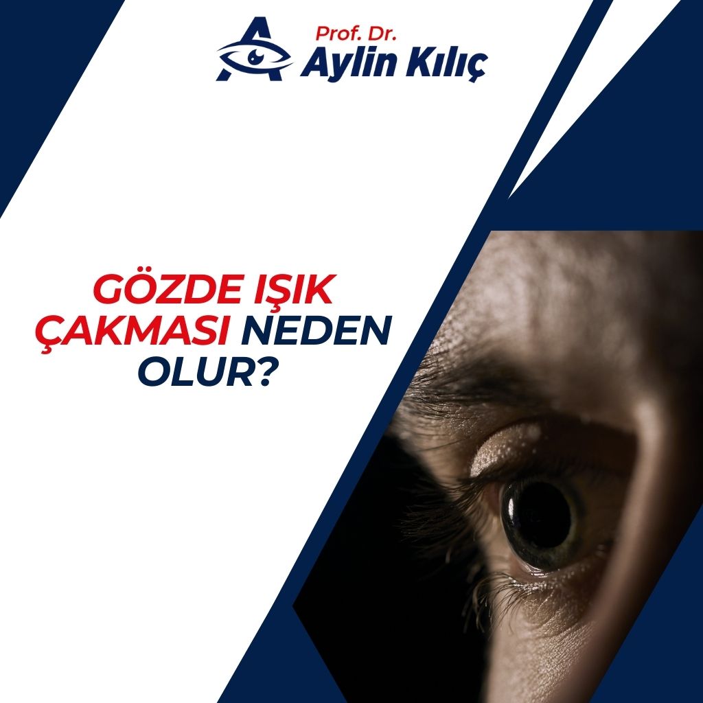 Gözde Işık Çakması Neden Olur  