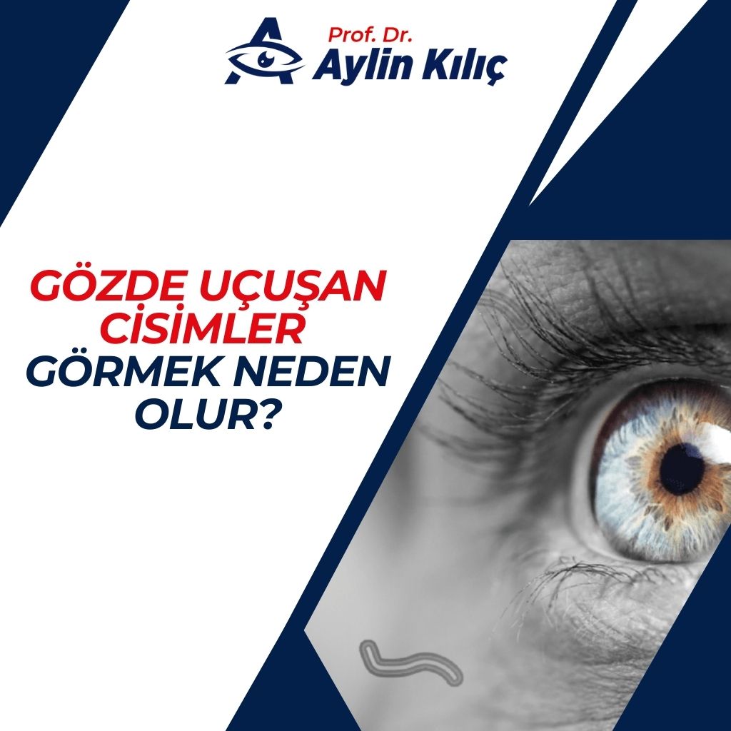 Gözde Uçuşan Cisimler Görmek Neden Olur