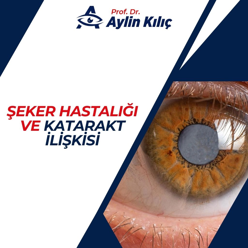 Şeker Hastalığı ve Katarakt İlişkisi
