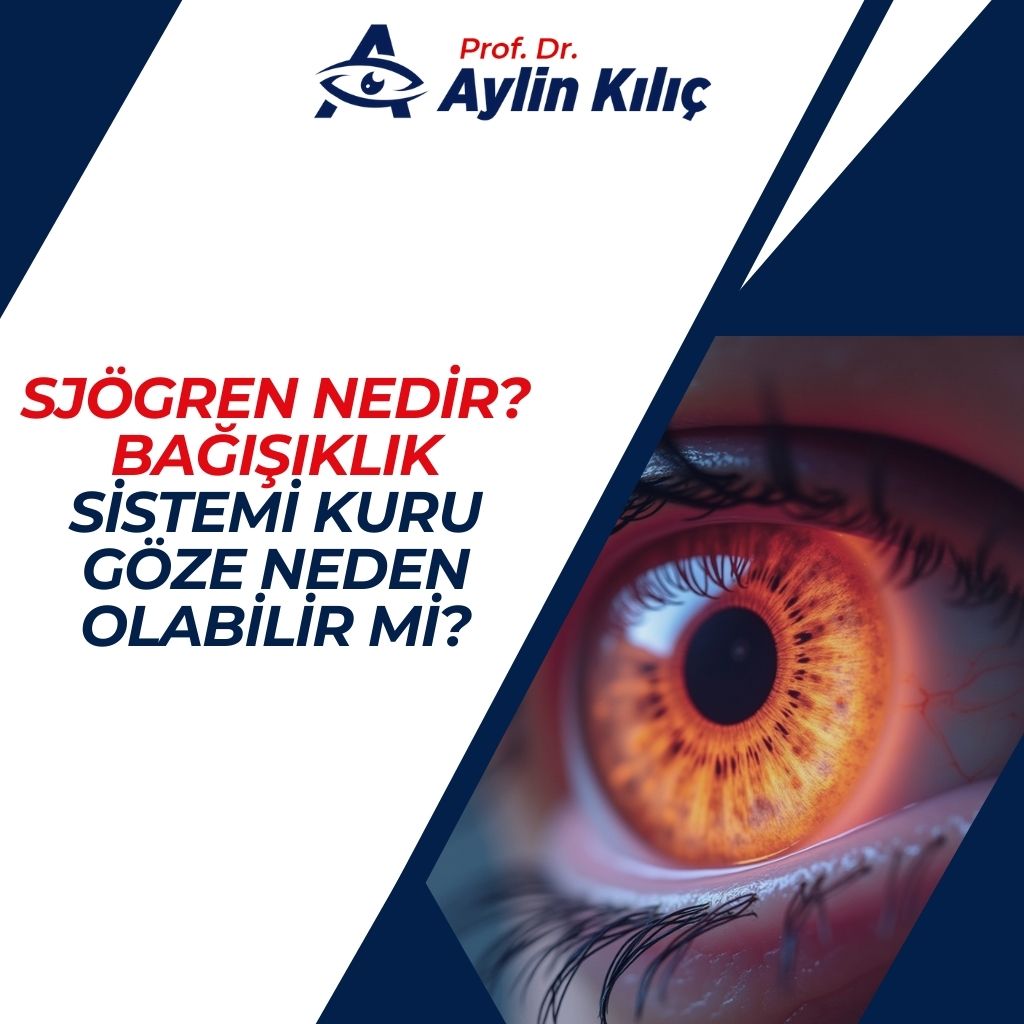 Sjögren Nedir Bağışıklık Sistemi Kuru Göze Neden Olabilir mi