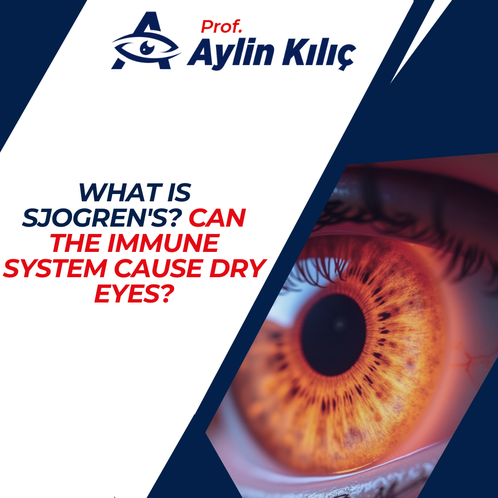 What is Sjögren's Can the Immune System Cause Dry Eyes