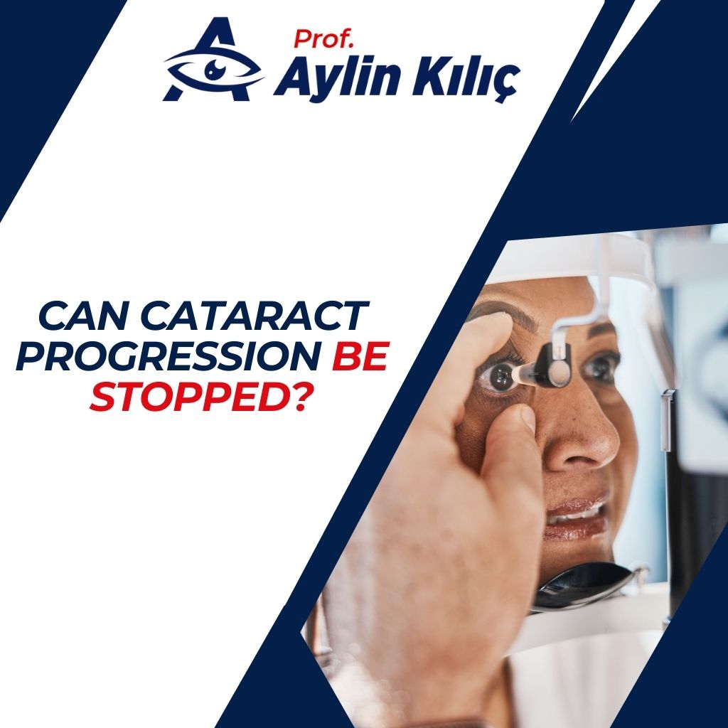 Can Cataract Progression Be Stopped