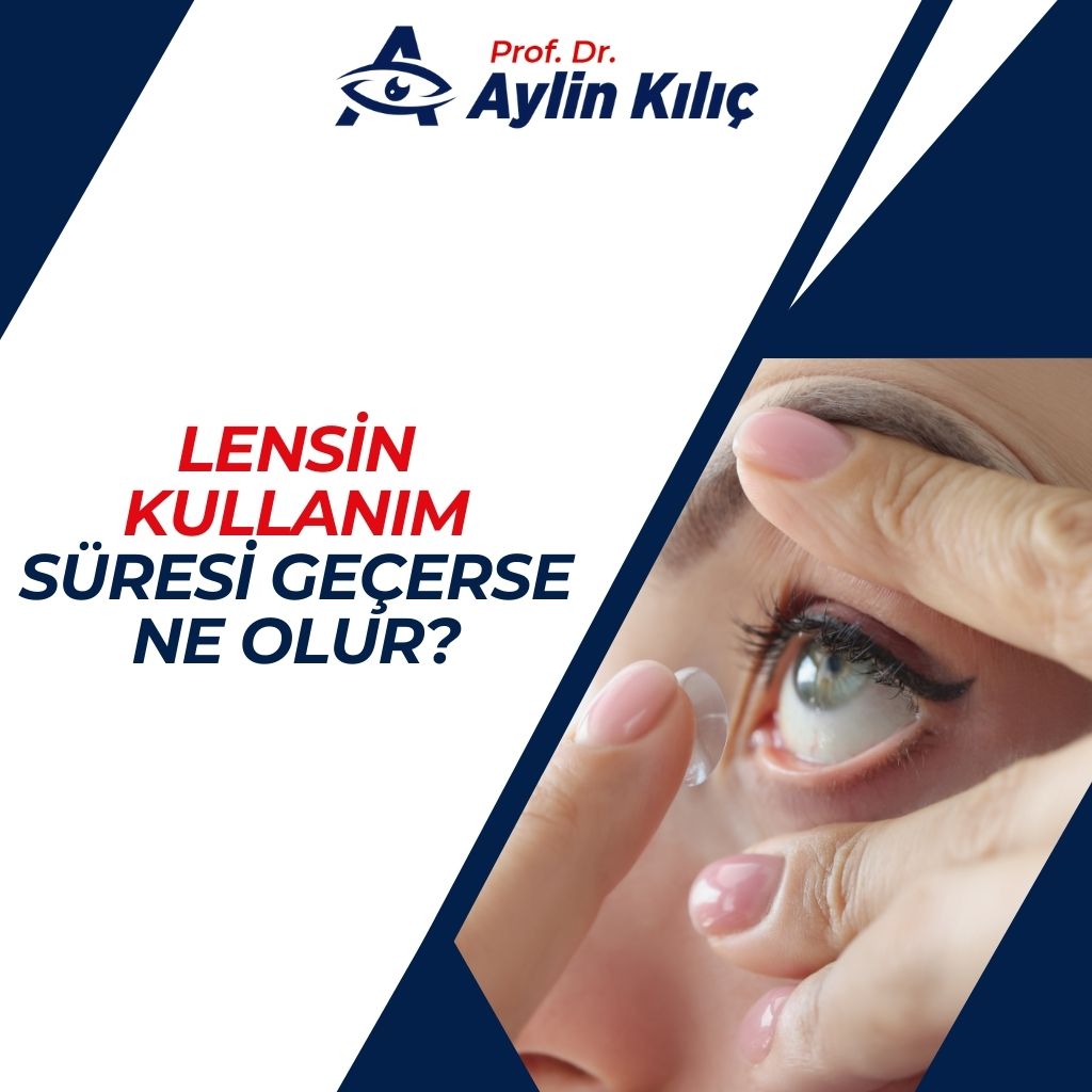 Lensin Kullanım Süresi Geçerse Ne Olur