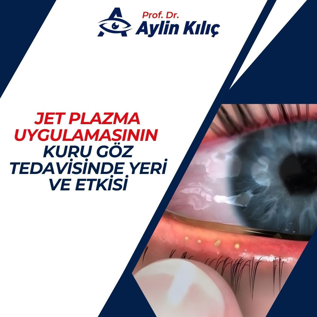 Jet Plazma Uygulaması