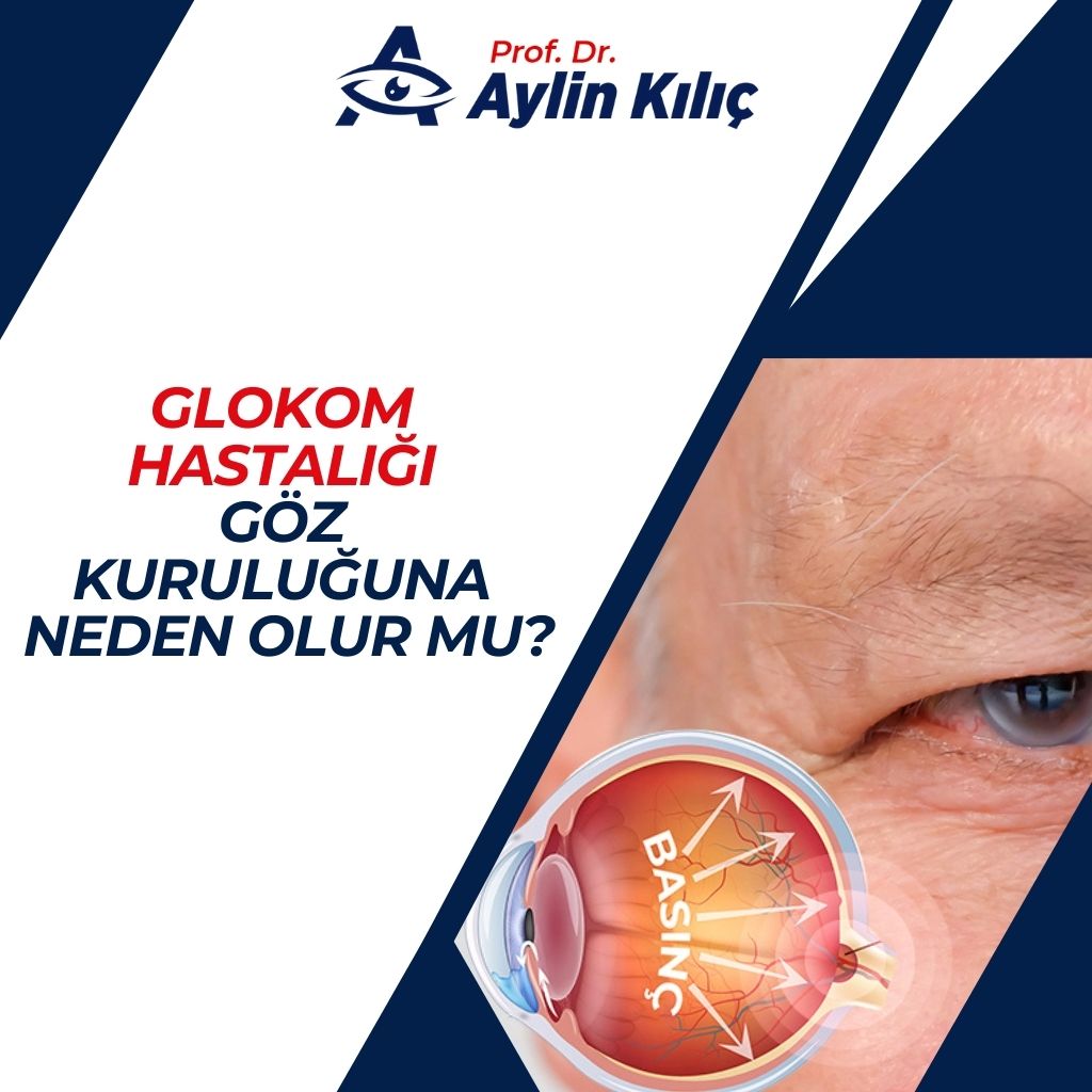 Glokom Hastalığı Göz Kuruluğuna Neden Olur mu