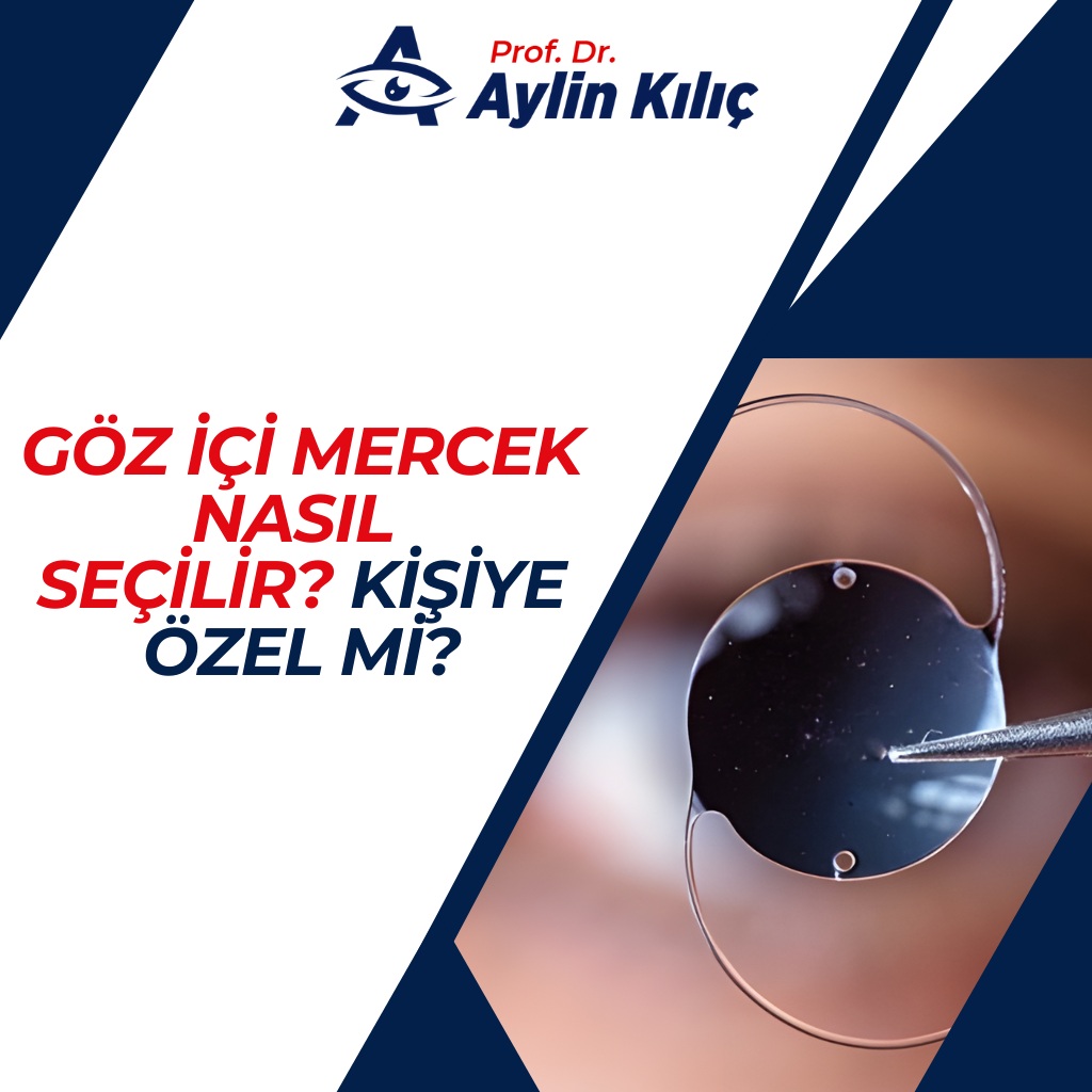Göz içi mercek nasıl seçilir