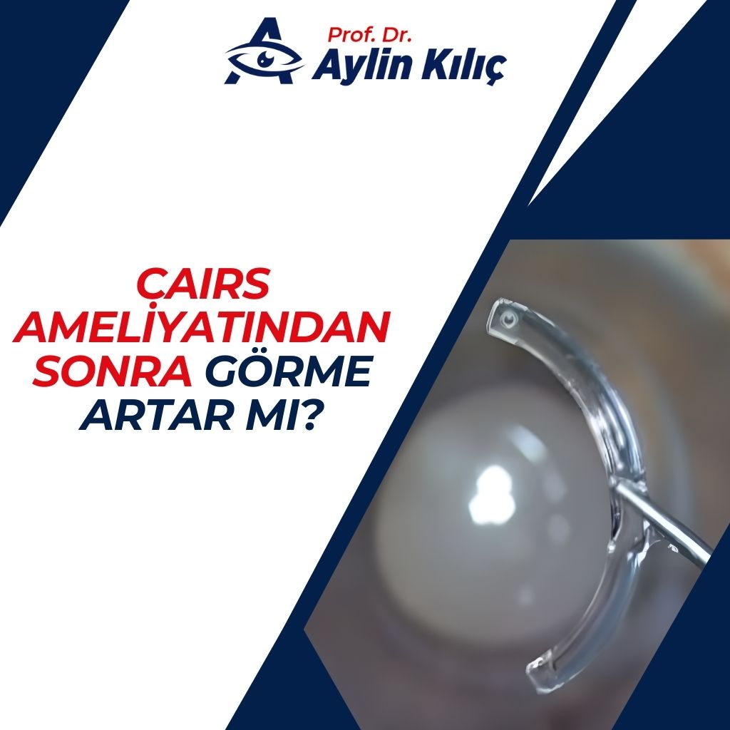 CAIRS ameliyatından sonra görme artar mı