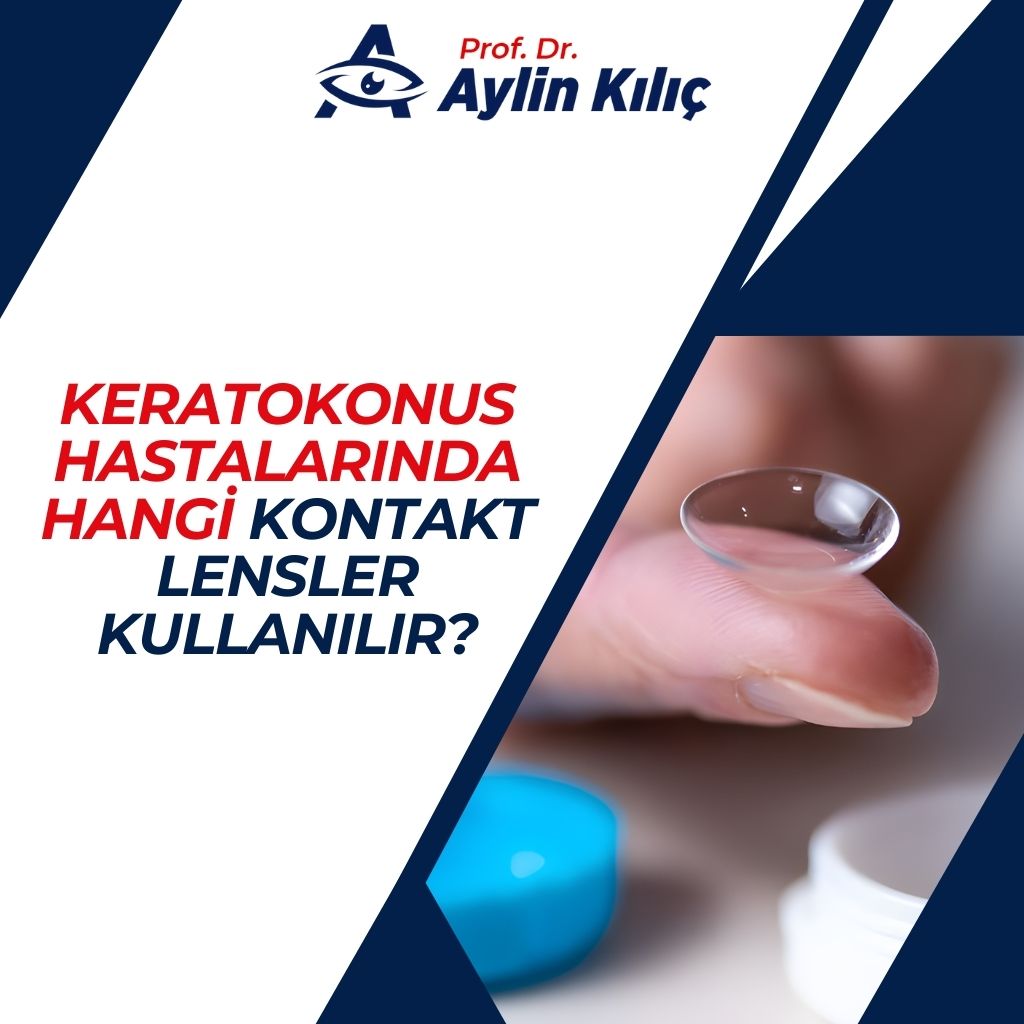 Kontakt Lensler Kullanılır 1
