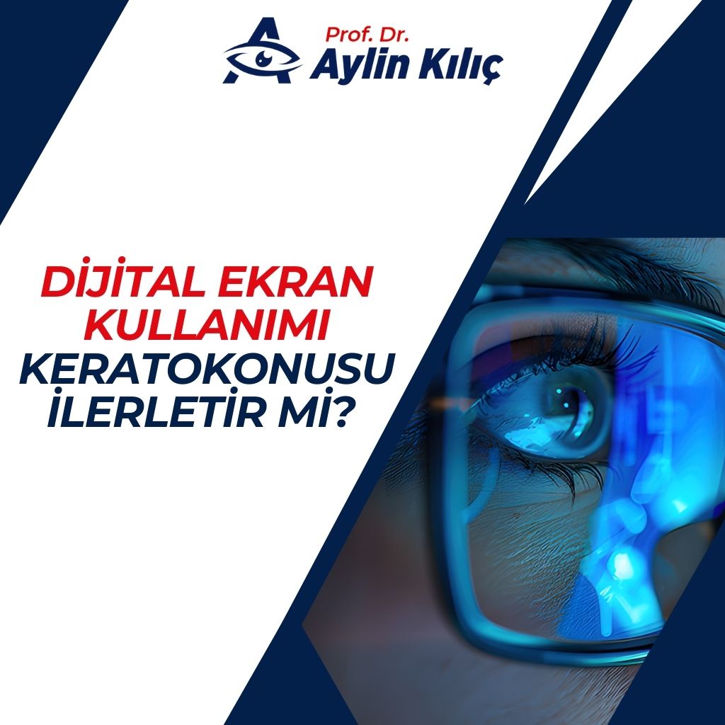 Dijital Ekran Kullanımı Keratokonusu İlerletir mi 2