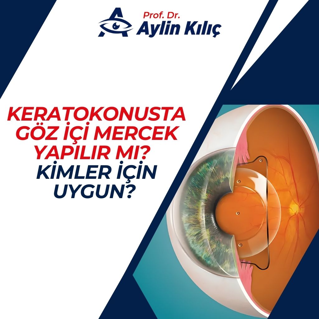Keratokonusta Fakik göz içi mercek