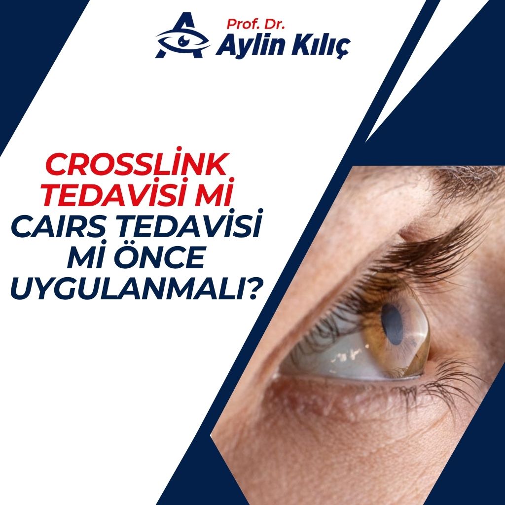 Crosslink Tedavisi mi CAIRS Tedavisi mi Önce Uygulanmalı