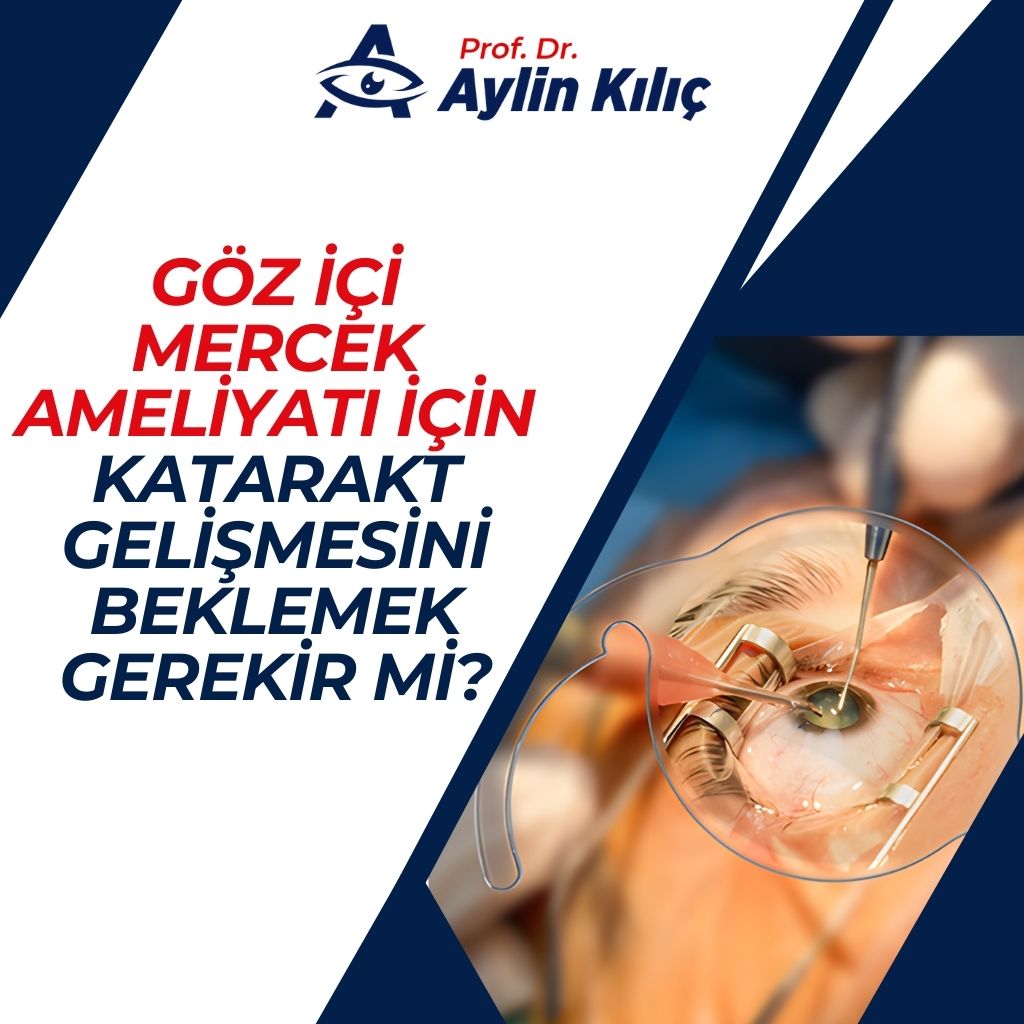 Katarakt Gelismesini Beklemek Gerekir mi
