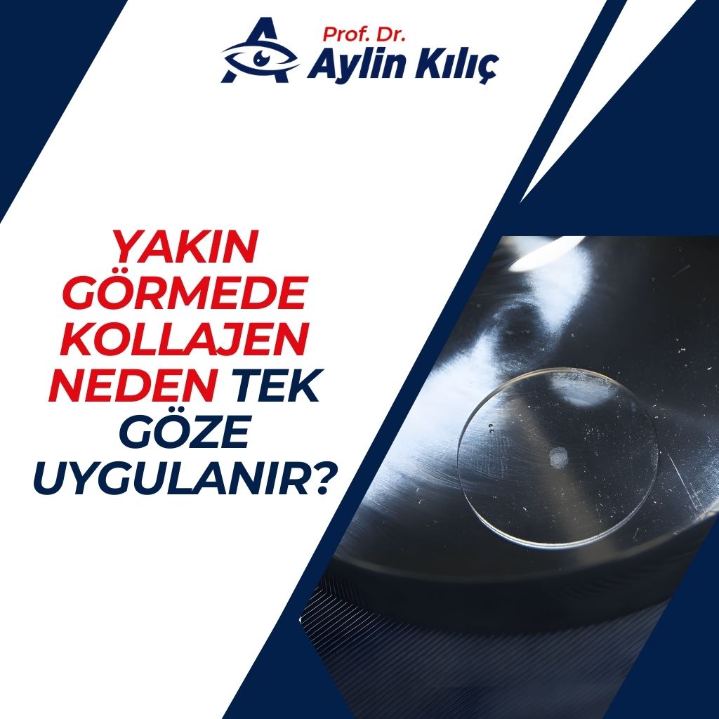Yakın görmede kollajen neden tek göze uygulanır