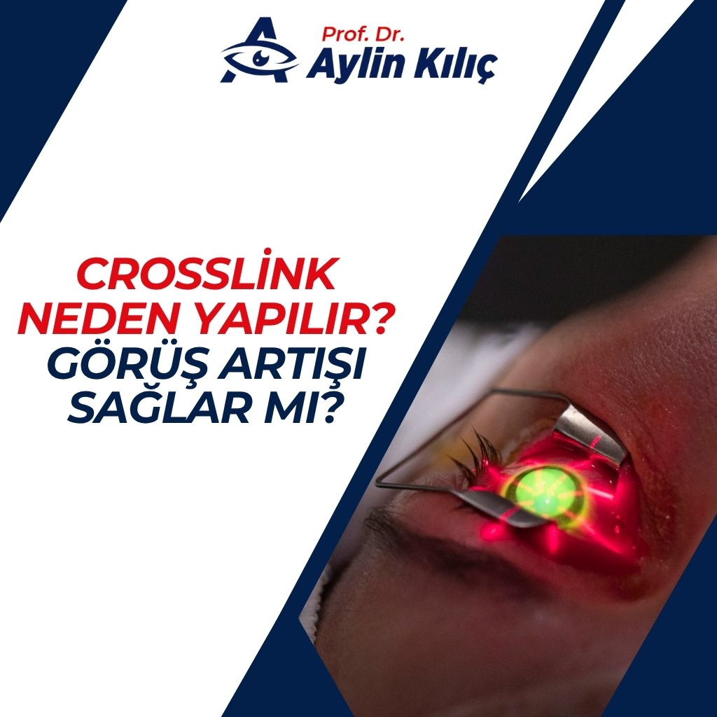 Crosslink Görüş Artışı Sağlar mı