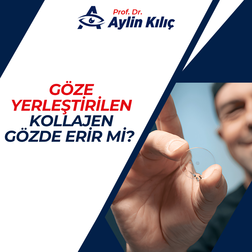Gözümüze Yerleştirdiğimiz Kollajen Gözde Erir mi? 