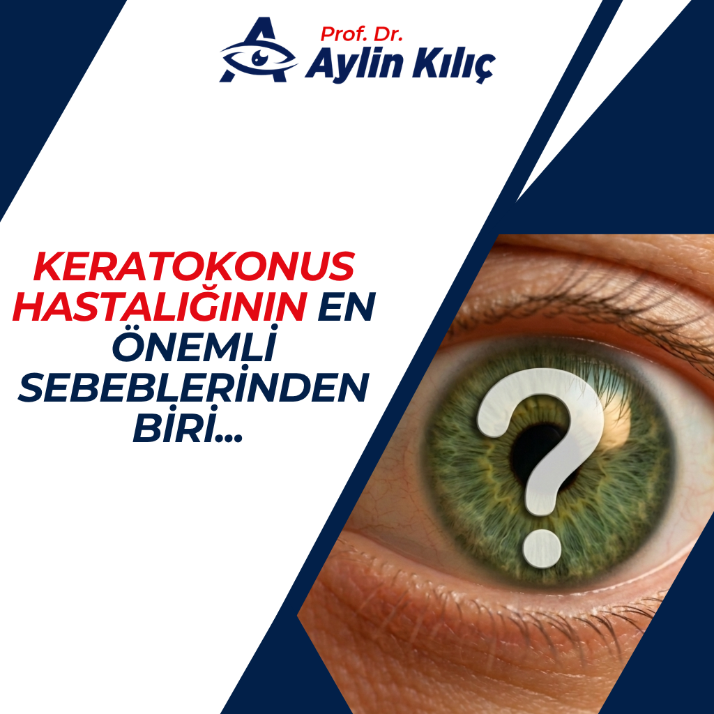 Keratokonus Hastalığının En Önemli Sebeblerinden Biri...