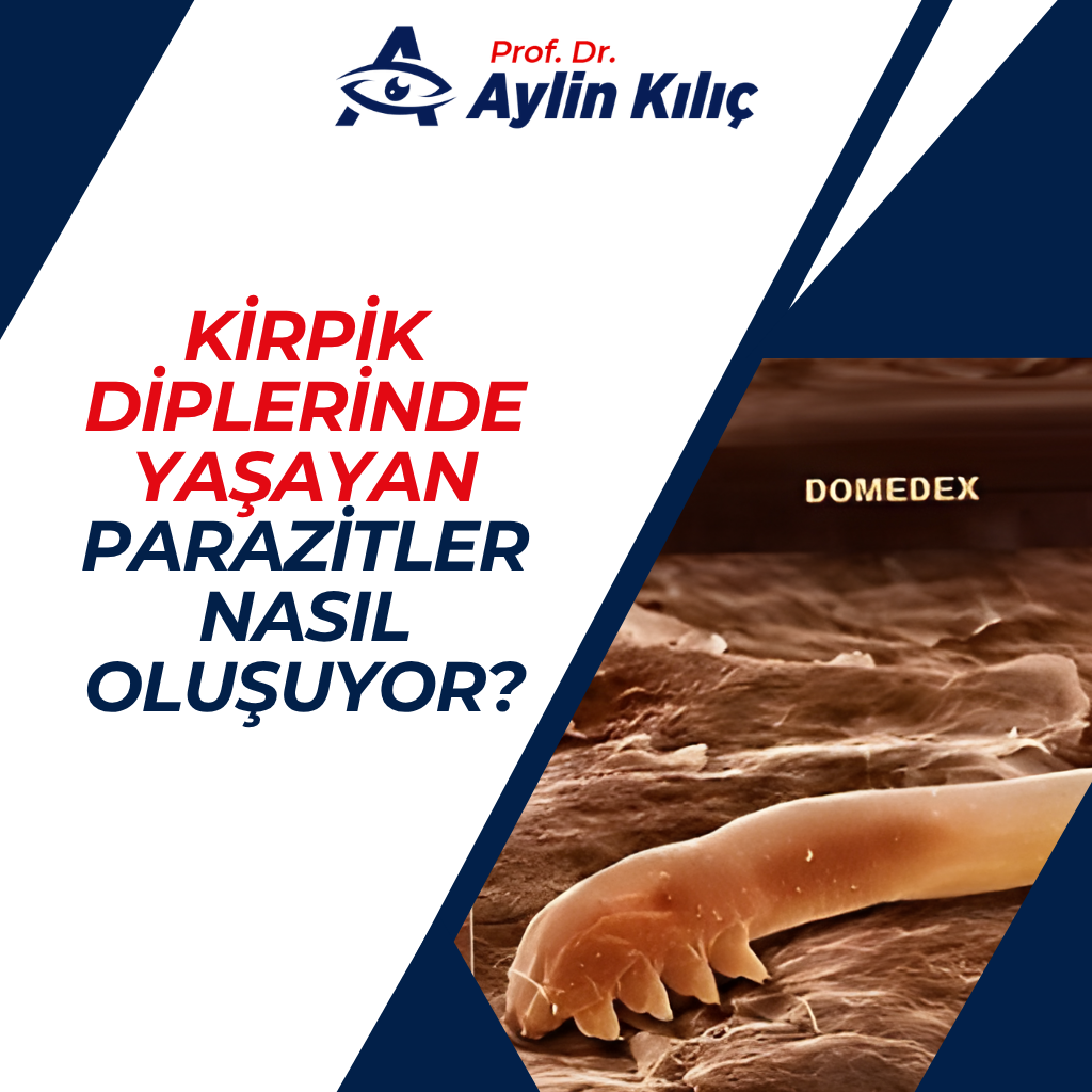 Kirpik diplerinde Yaşayan Parazitler Nasıl Oluşuyor