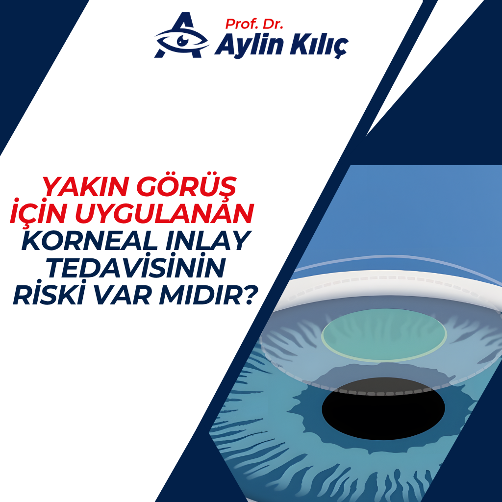 Yakın Görüş için Uygulanan Korneal Inlay Tedavisinin Riski Var mıdır? 5 Korneal Inlay Tedavisinin Riski Var midir