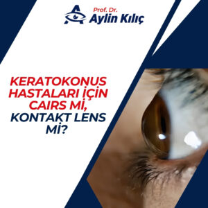 CAIRS mi, Kontakt Lens mi