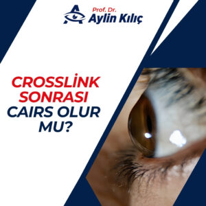 Crosslink sonrasi CAIRS