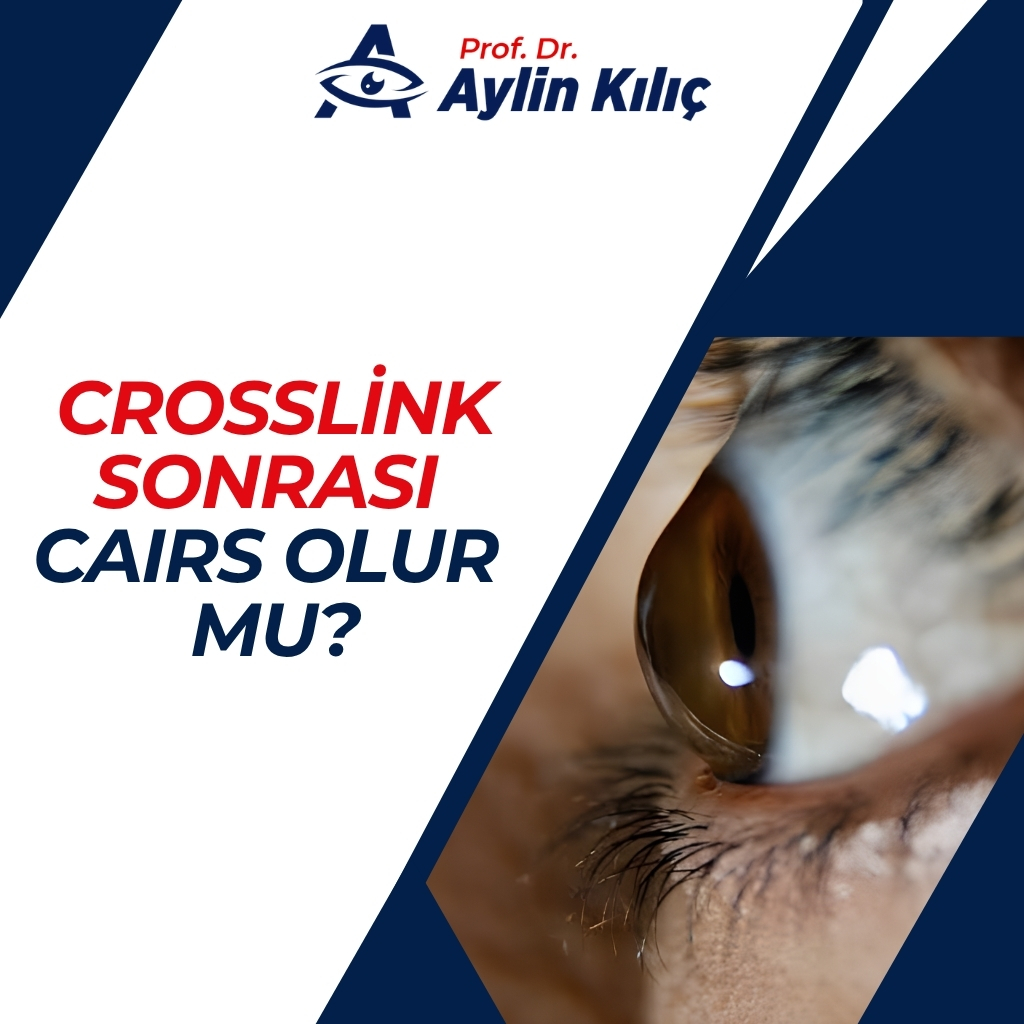 Crosslink Sonrası CAIRS Olur mu? 2 Crosslink sonrasi CAIRS