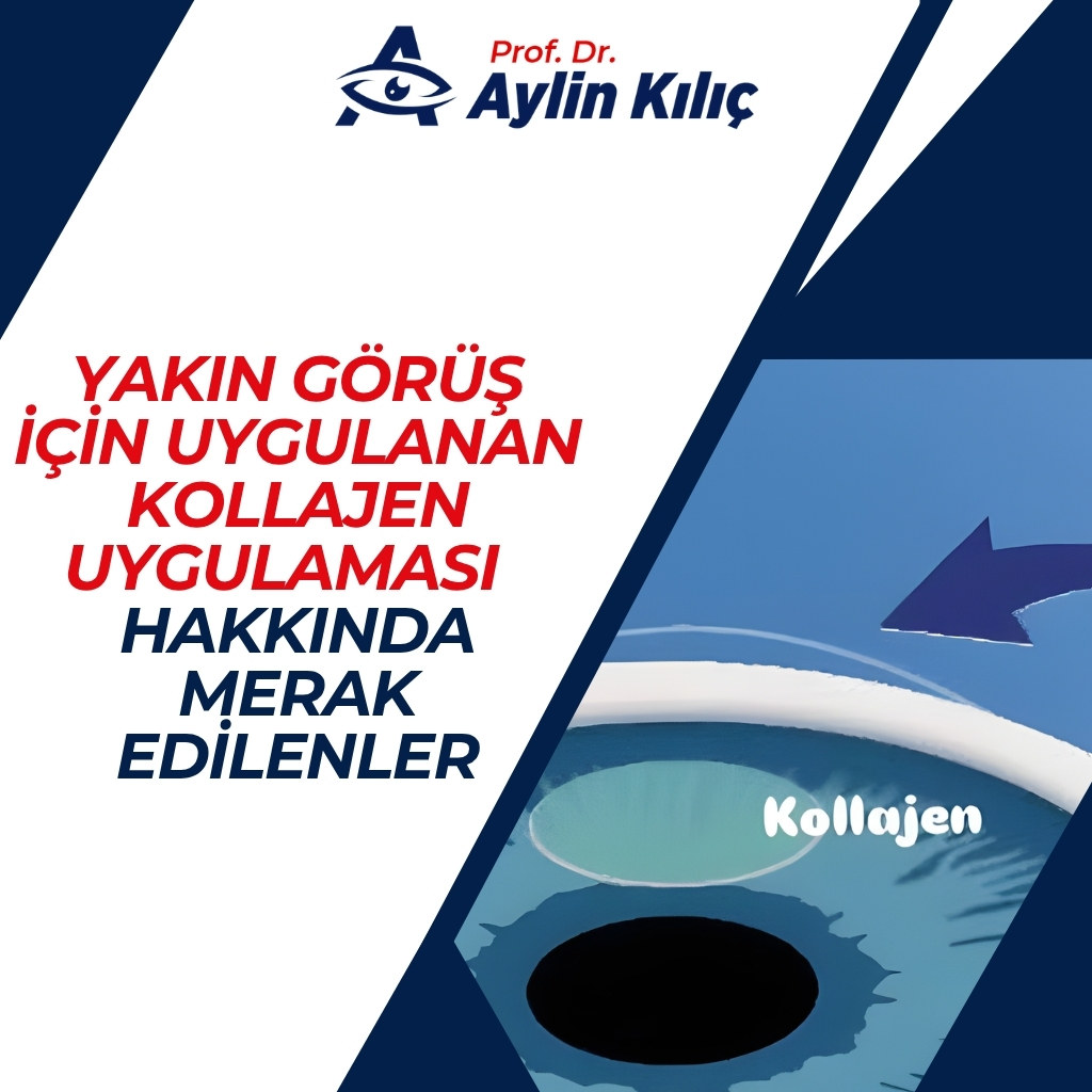 Yakın Görüş için Uygulanan Kollajen Uygulaması Hakkında Merak Edilenler 1 Kollajen Hakkinda Merak Edilenler