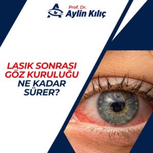 LASIK Sonrasi Goz Kurulugu Ne Kadar Surer 2