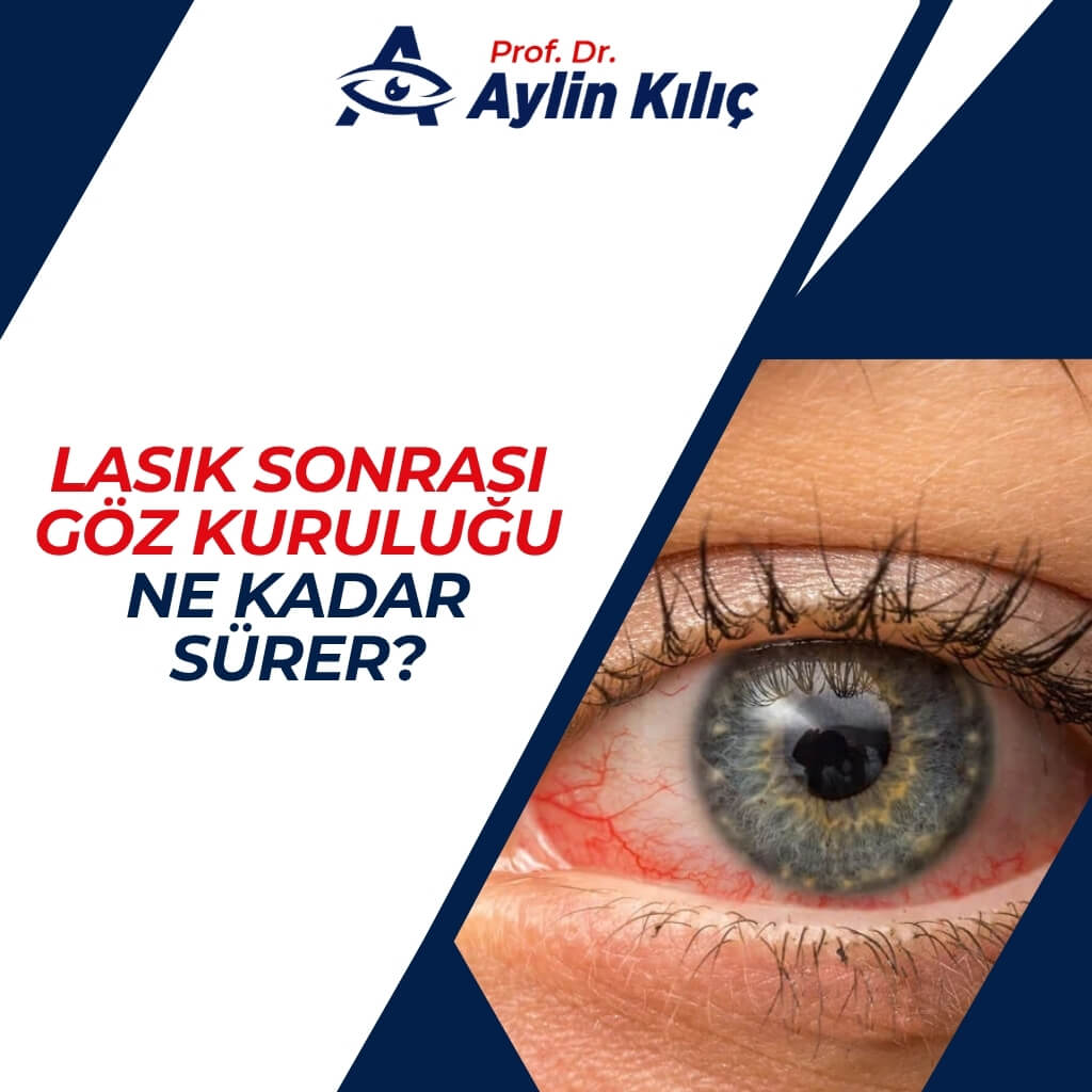 LASIK Sonrasi Goz Kurulugu Ne Kadar Surer 2