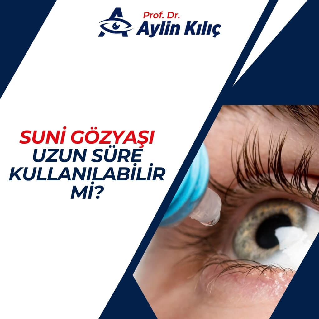 Suni gozyasi uzun sure kullanilabilir mi