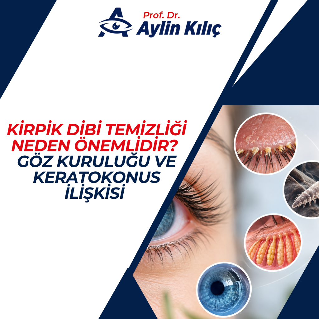 Goz Kurulugu ve Keratokonus Iliskisi