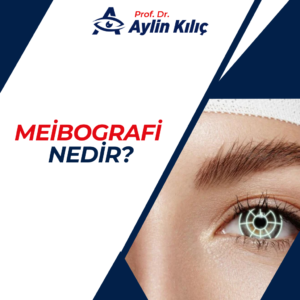 Meibografi Nedir