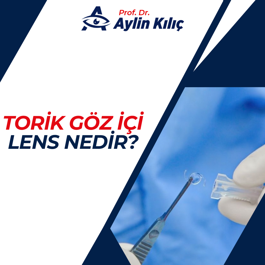 Torik goz ici lens