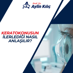 keratokonusun Ilerledigi Nasil Anlasilir